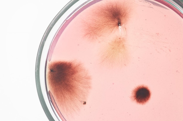 Microorganism sample in petri dish