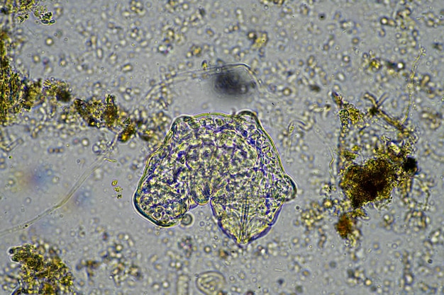 Photo microorganisms and a tardigrade in a soil sample on a farm