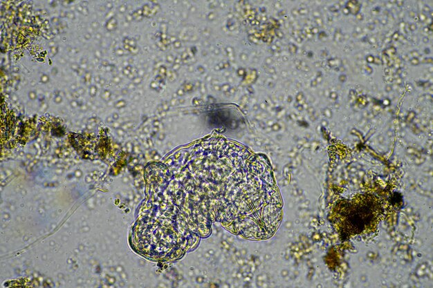 Microorganisms and a tardigrade in a soil sample on a farm