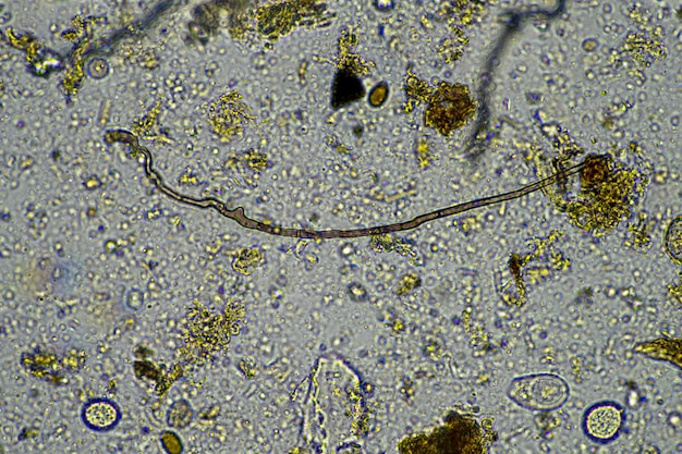 Photo microscopic fungus and microorganisms in a sample in australia