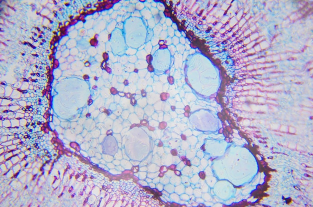Foto fotografia al microscopio nucleo di uno stelo di xylophyta dicotiledone, sezione trasversale.