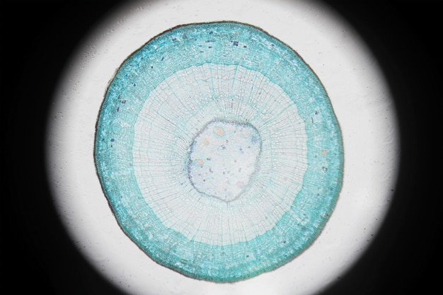 나무 dicotyledon, 횡단면의 증기의 현미경 사진.