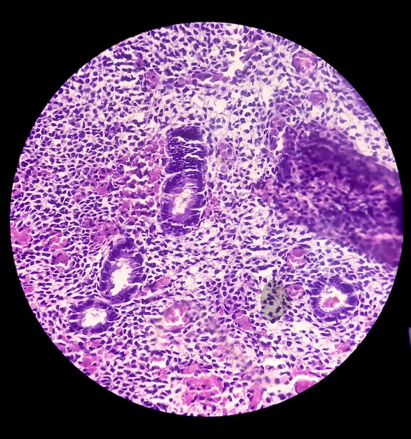 microscopic view of FNAC of histological slide of a tissue sample