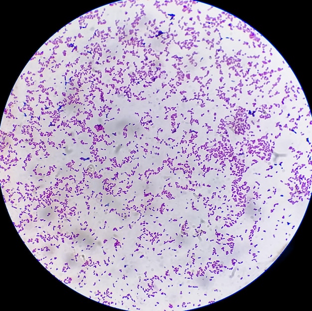 Microscopic view of gram stain showing Escherichia coli or E coli bacteria