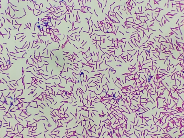 Microscopic view of gram stain showing rod shape Escherichia coli or E. coli bacteria.