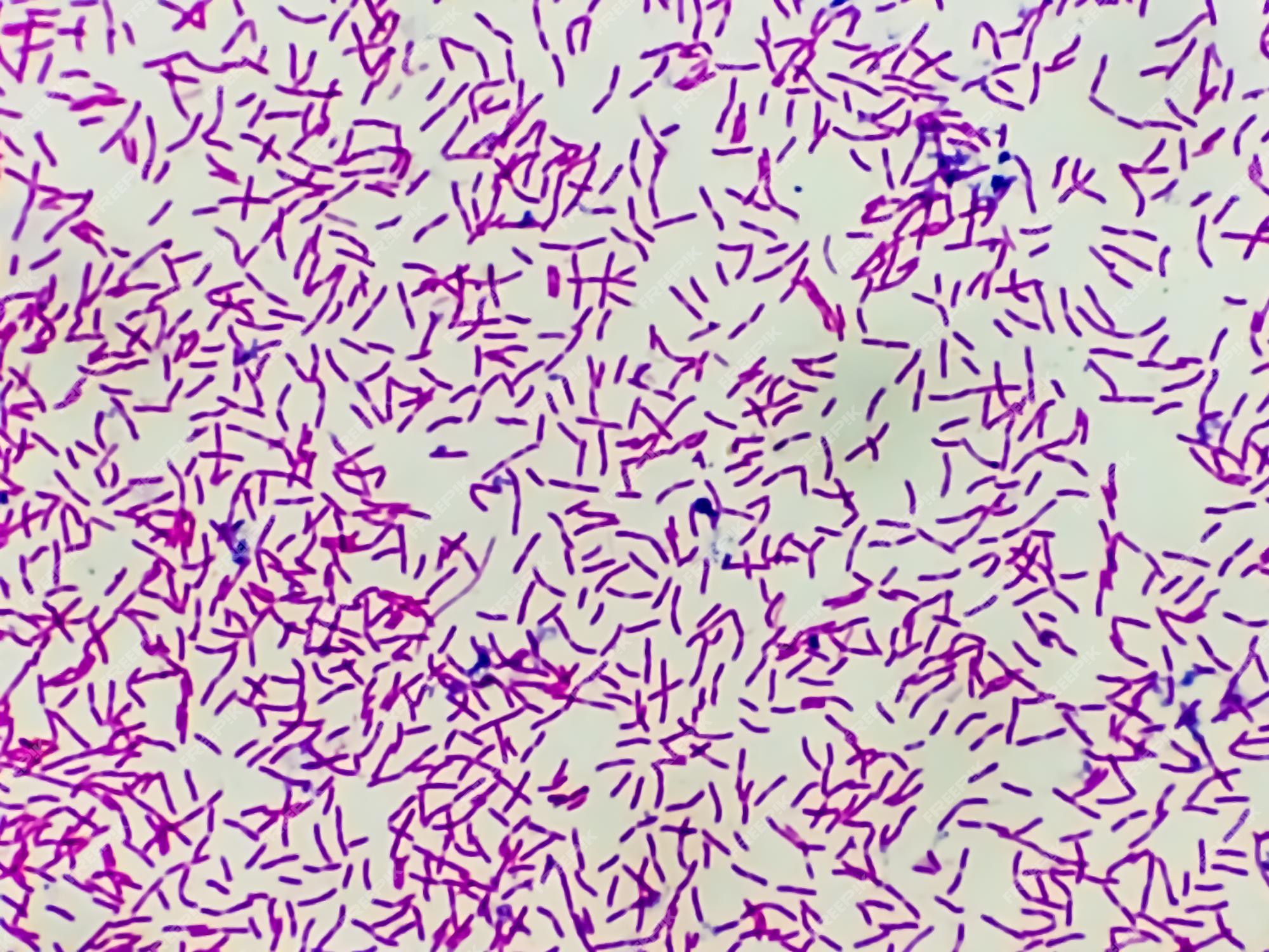 Gram Stain E Coli