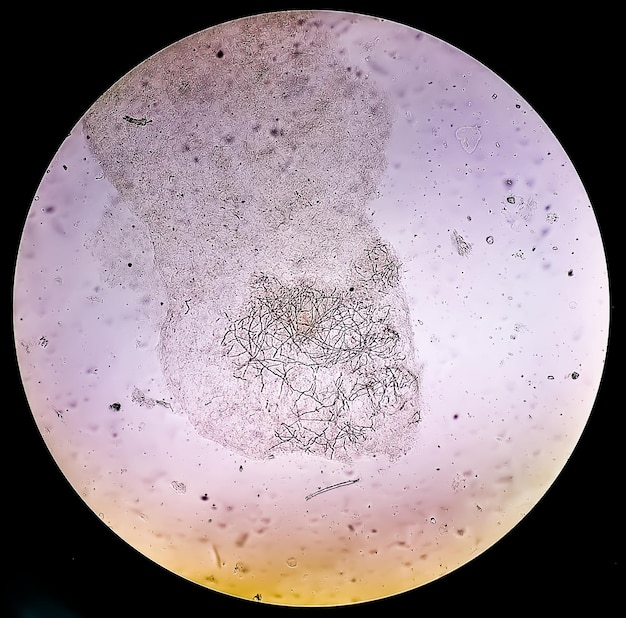 Foto microscopisch beeld van huidschrapen voor schimmeltest met dermatofyten