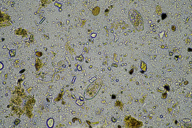 microscopische schimmels en micro-organismen in een monster in Australië