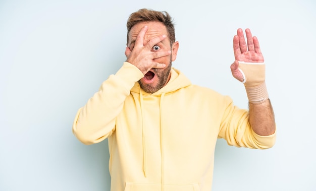 Middle age handsome man looking shocked, scared or terrified, covering face with hand. broken hand concept