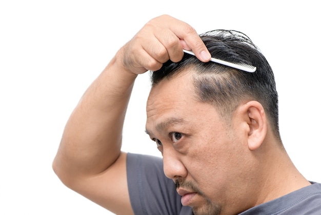 L'uomo asiatico di mezza età si preoccupa per la sua perdita di capelli o alopecia e capelli grigi isolati