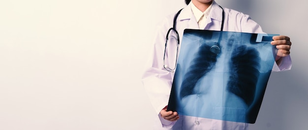 중년의 아시아 여성 의사가 서서 엑스레이 필름이나 방사선 사진을 들고 있다