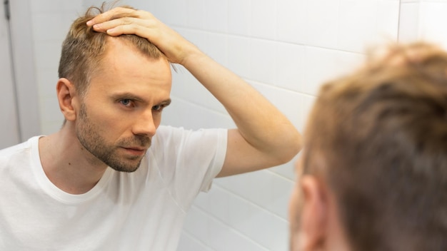 Middle aged caucasian white man with a short beard looks at his hair in the mirror in the bathroom and worried about balding The concept of the problem of male hair loss early baldness and alopecia