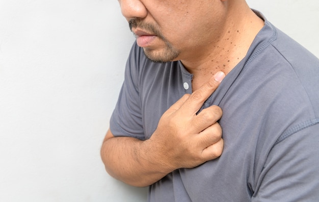 A middle aged man pointed a finger at Skin Tags or Acrochordon on his neck on white wall. Skin problems of older people