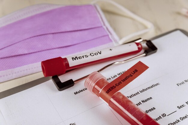 Photo middle east respiratory syndrome coronavirus blood merscov test adding fluid