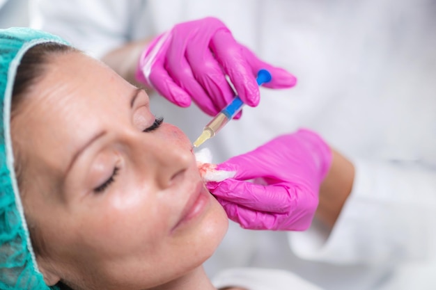 Midsection of doctor injecting syringe on woman face