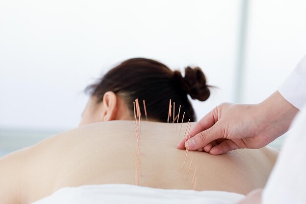 Photo midsection of doctor treating patient with acupuncture therapy in clinic