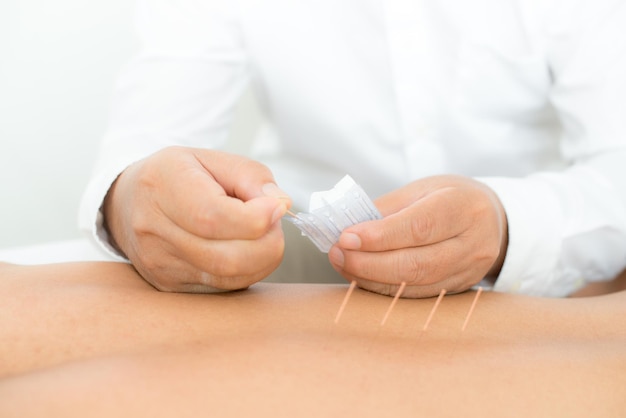 Photo midsection of man doing acupuncture