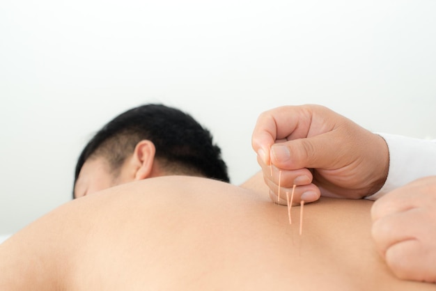 Photo midsection of man receiving acupuncture therapy