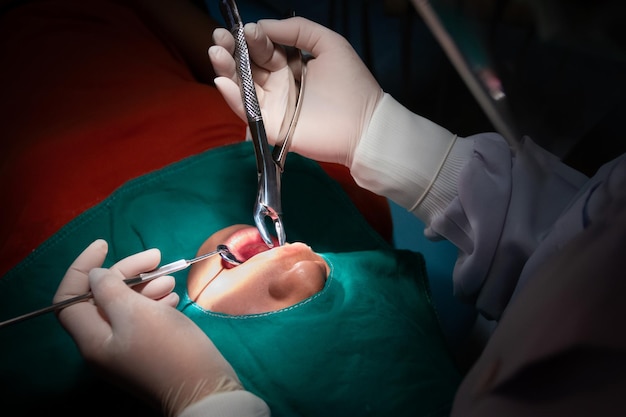写真 歯科医が手術している患者の中間部