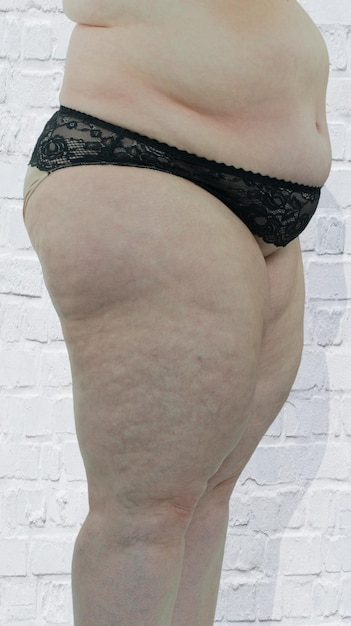 Midsection of overweight woman wearing panties standing against white wall