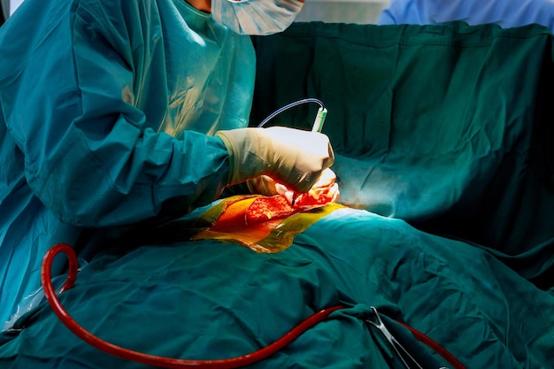 Photo midsection of surgeon performing surgery on patient