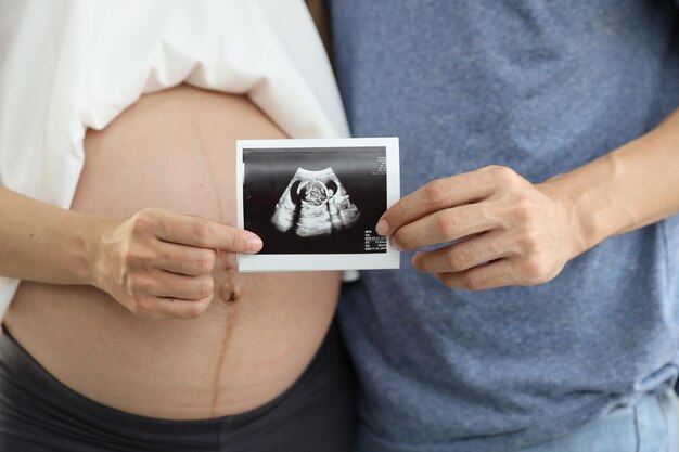 Foto sezione centrale di una donna che si tiene per mano