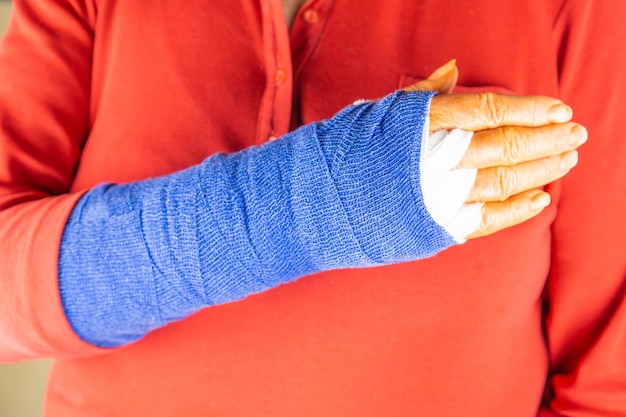 Midsection of woman with fracture hand