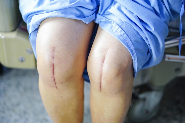 Photo midsection of woman with scars on bed