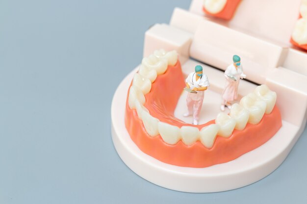 Miniatuurmensen: tandarts die menselijke tanden met tandvlees en glazuur herstelt, gezondheids- en medisch concept