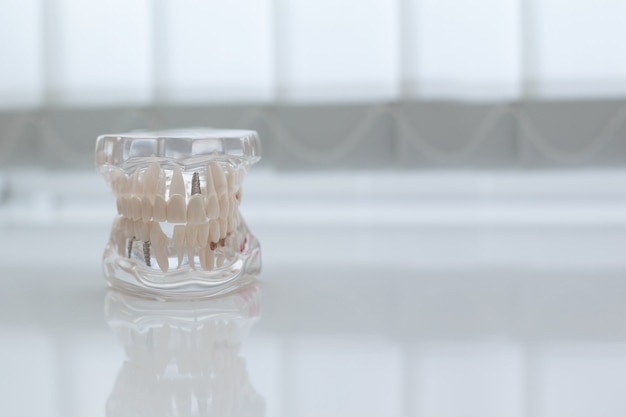 Model of artificial jaw on the table in the dental office