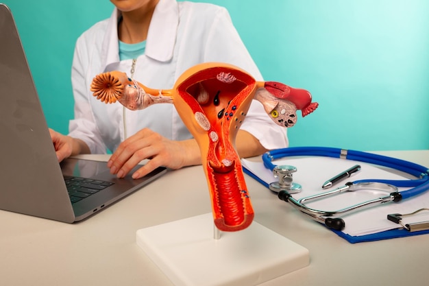 Model female reproductive organs on work desk of doctor