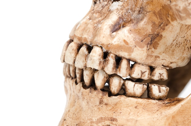 Model of human teeth (skull) on a white background