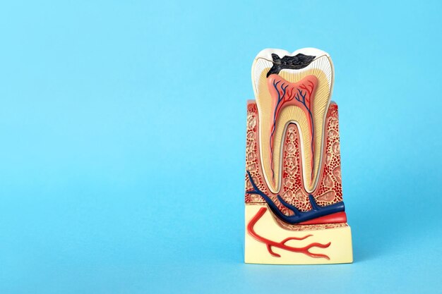 Model of imitation of a tooth made of plastic at the initial stage of caries