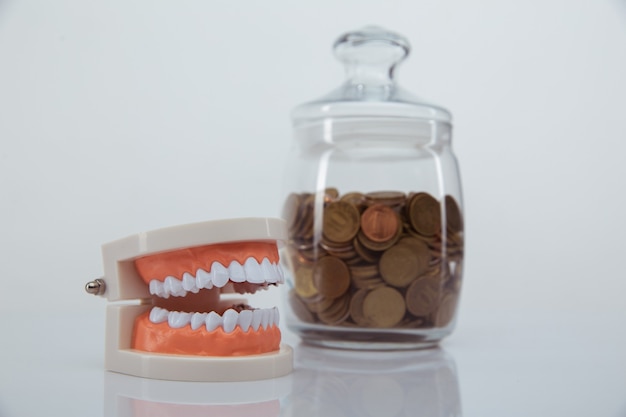 Model of jaw and glass bank with coins close-up. Expensive dentist's services concept