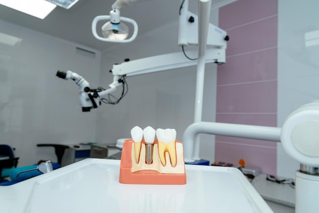 Фото Модель зубов в стоматологическом кабинете