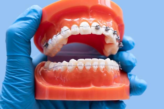 Foto modello di denti nelle mani modello di addestramento dentale dei denti mascella artificiale