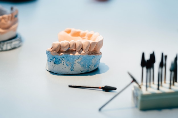 歯科技工士のための顎の石膏で作られた歯のモデル