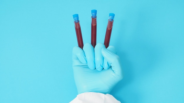 Model with PPE cloth and Hand with glove is holding blood test tube on blue background.