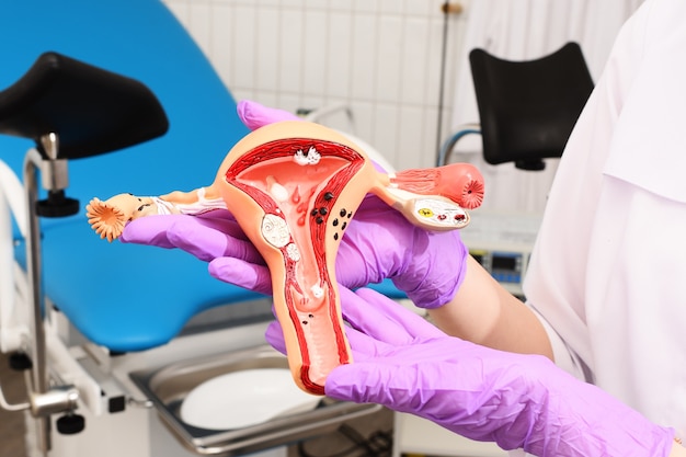 A model of a woman's uterus in the hands of a doctor