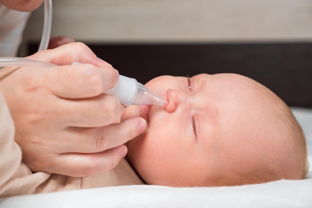 Foto moeder reinigt neus van meisje van snot met behulp van aspirator