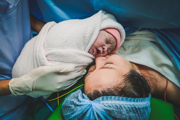 mommy and baby newborn in the cesarean section first sight of mom and her newborn in operation room