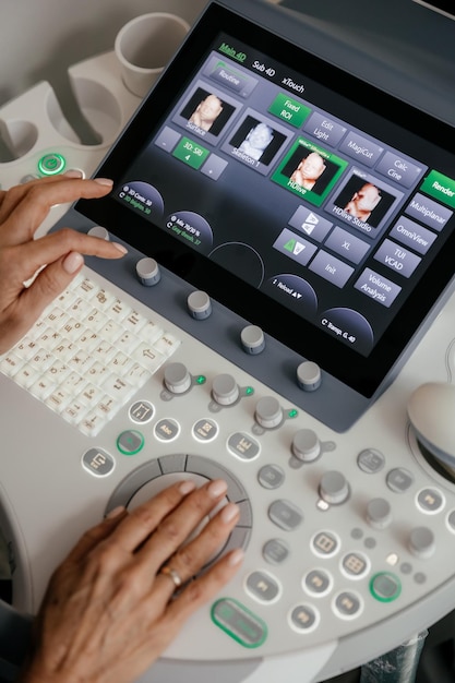 The monitor of the ultrasound machine with a scanned image of the baby