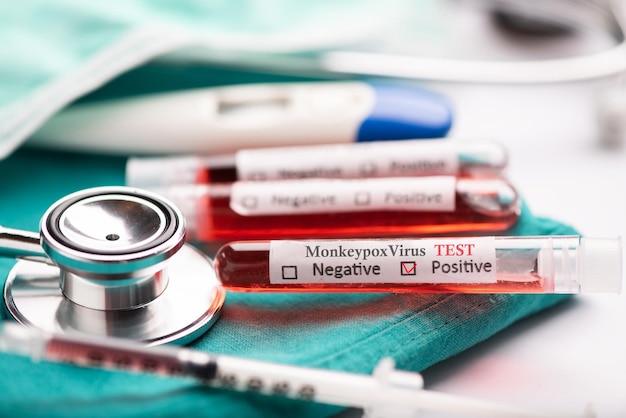 Photo monkey pox test tube on medical desk