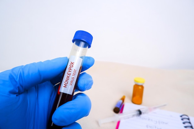 Monkeypox MPXV blood sample in test tube holding by doctor hand