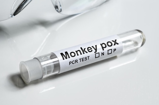 Monkeypox PCR reageerbuis close-up Apparatuur voor diagnostiek van het apenpokkenvirus