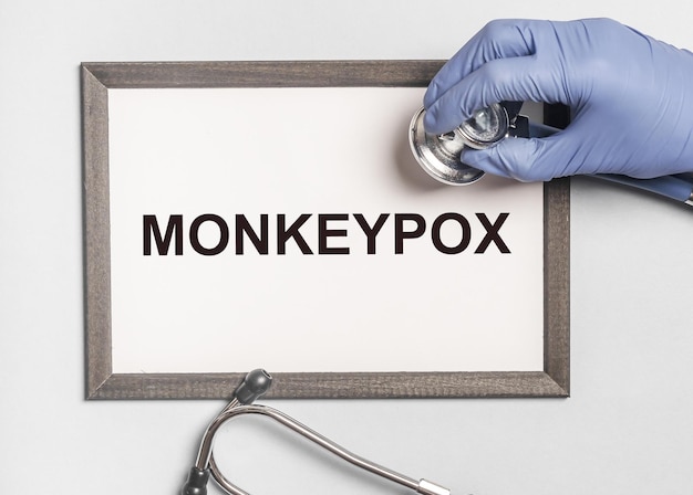 Monkeypox virus concept Monkey smallpox type