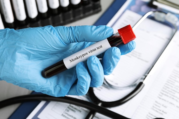 Monkeypox 바이러스 테스트 테이블 근접 촬영 위에 혈액 샘플 튜브를 들고 실험실 작업자