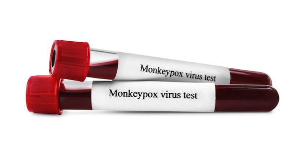 Monkeypox virus test Sample tubes with blood on white background