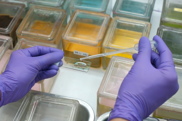 Foto montageglaasje met afdekglas, kleurglaasje uitstrijkje voor cytologie, laboratorium