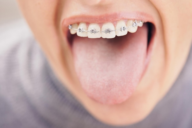 mooi meisje in glazen en beugels glimlachend op een witte achtergrond tandarts orthodontist concept